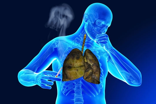 Akciğer Temizliği İçin Bitkisel Yöntemler 1