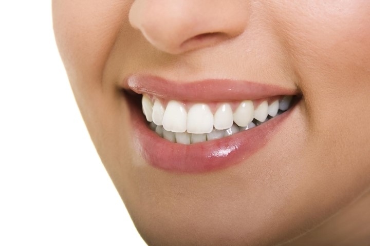 Diş Çürüklerini Önlemenin 10 Yolu 3