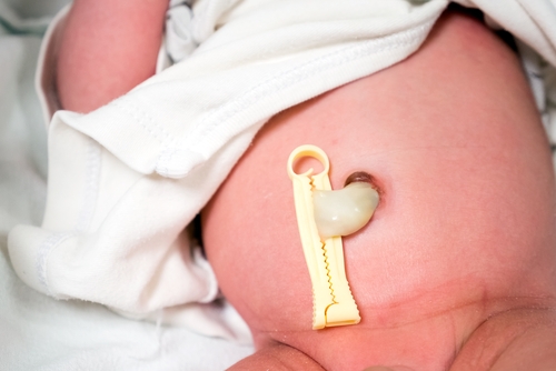 Doğum Çantasında Neler Olmalı ve Yeni Doğan Bebeklerin İhtiyaçları 8