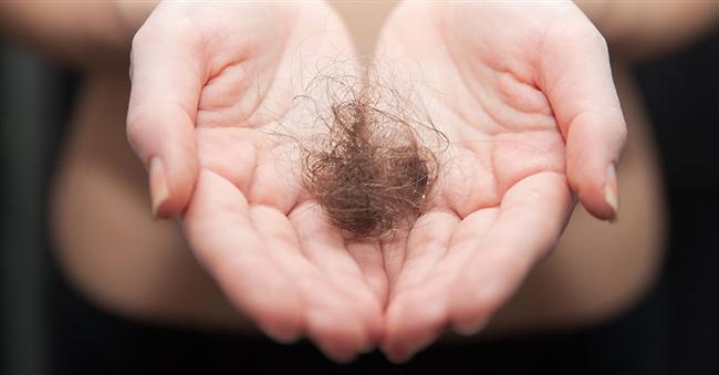 Saç Dökülmesinin Nedenleri ve Çözümleri 13
