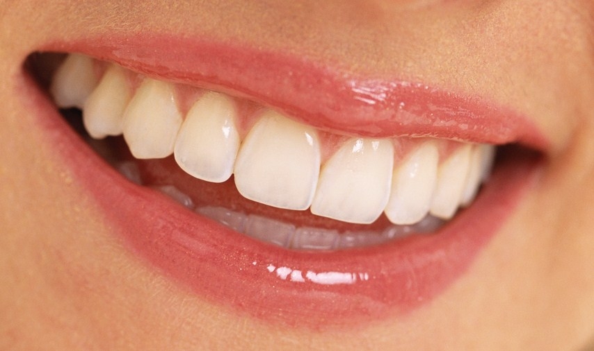 Sağlıklı Dişlere Sahip Olmanın Yolları 8