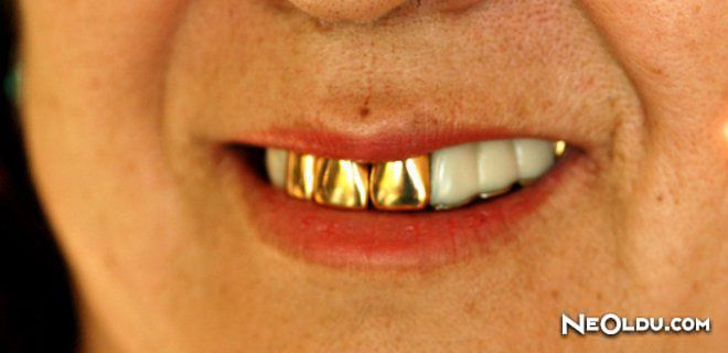 Rüyada Altın Diş Görmek: Manevi Anlamlar