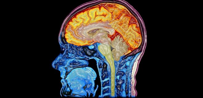 ensefalit beyin iltihabi nedir ve belirtileri nelerdir