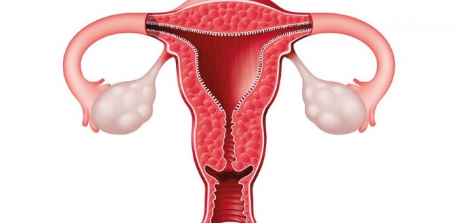 Endometrial Polip Nedir? Teşhisi ve Tedavi Yöntemleri
