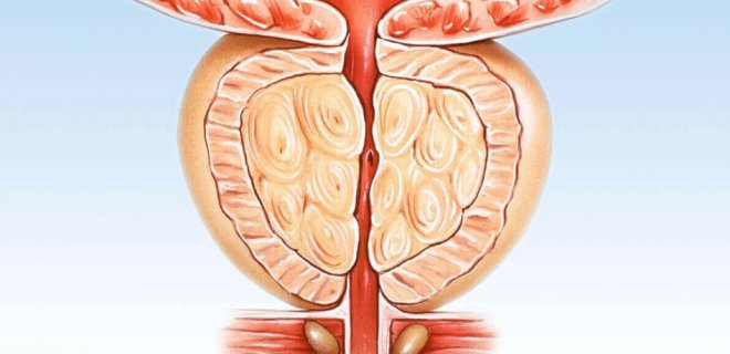 Prostat Buyumesi Tedavisi Prostat Buyumesine Iyi Gelen Bitkiler Sifali Bitkiler Saglik