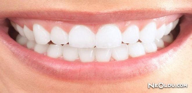 Diş ve Diş Eti Hastalıkları