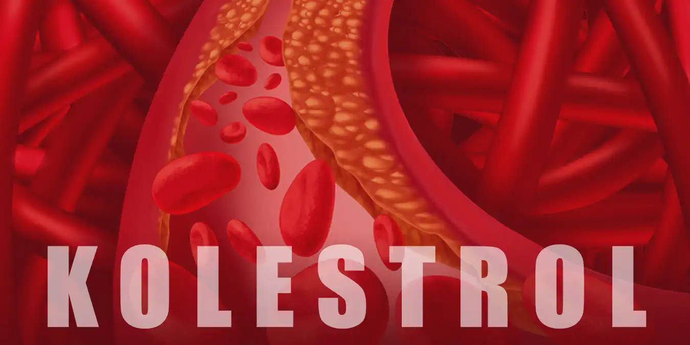 Kolesterol Nedir? Yüksek Kolesterol Belirtileri ve Tedavisi