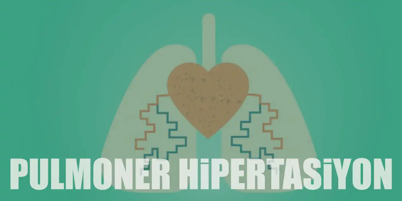Pulmoner Hipertansiyon Nedir ve Nasıl Tedavi Edilir?