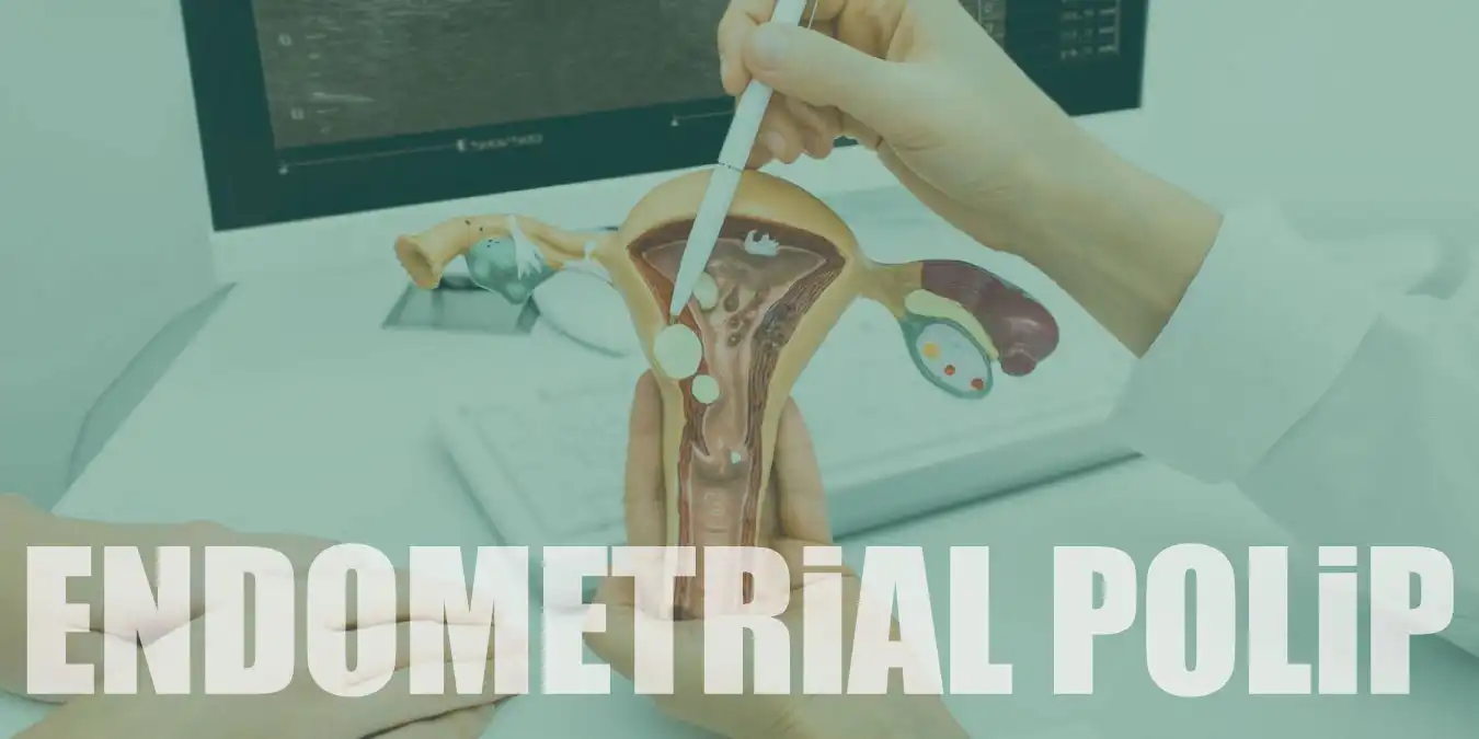 Endometrial Polip Nedir? Belirtileri ve Ameliyatı