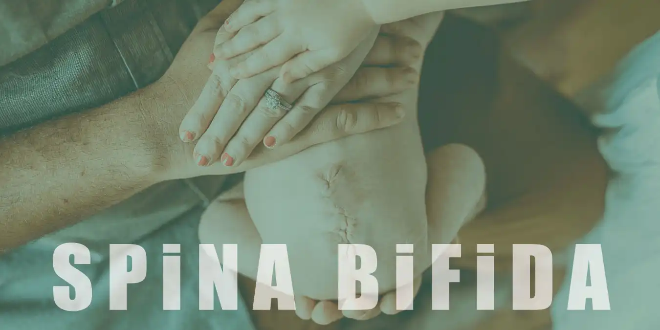 Spina Bifida Nedir? Belirtileri, Tanısı ve Tedavisi