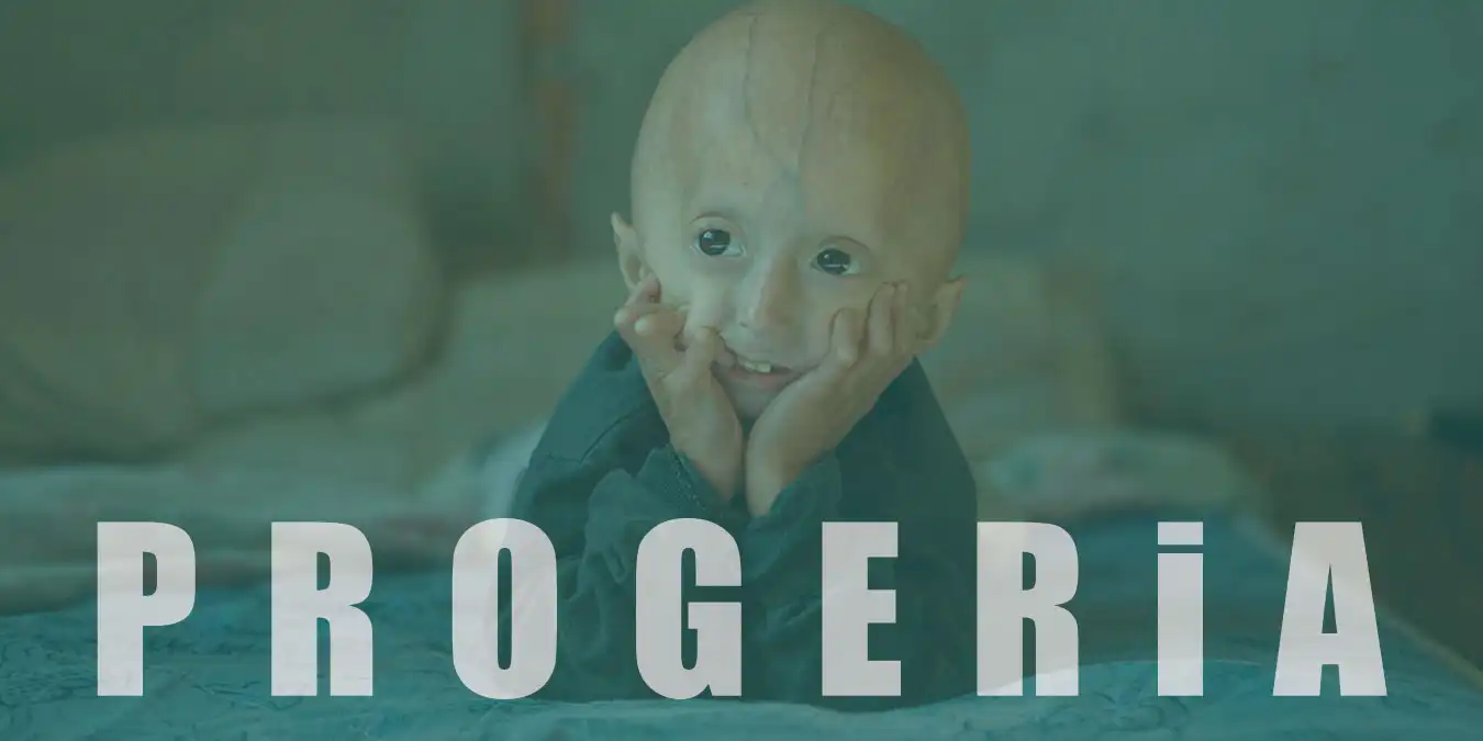 Progeria Nedir? Neden Olur ve Belirtileri Nelerdir?