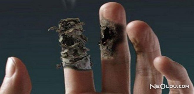 Buerger: 'Yalnızca Sigara İçenlerde Görülüyor'