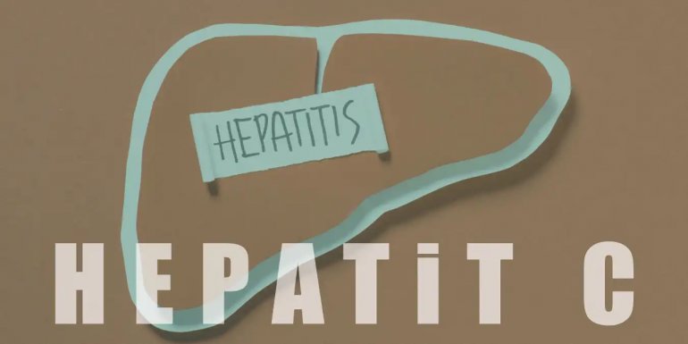 Hepatit C Nedir, Nasıl Bulaşır? Belirtileri ve Tedavisi