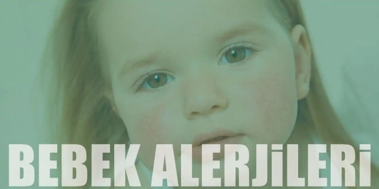 Bebeklerde Görülen Alerjiler, Belirtileri ve Tedavisi