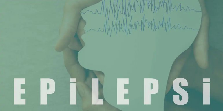 Epilepsi Nedir, Neden Olur, Belirtileri Nasıldır? Tedavisi
