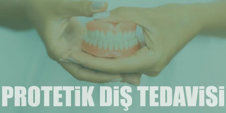 Protetik Diş Tedavisi Nedir, Çeşitlieri Nelerdir? Bakımı
