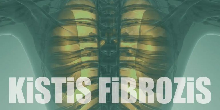 Kistik Fibrozis Nedir? Belirtileri, Tanısı ve Tedavisi