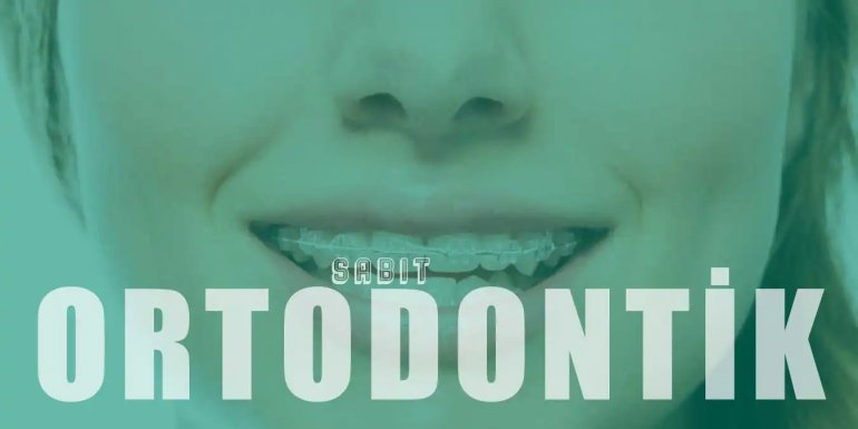 Sabit Ortodontik Tedavi Nedir, Nasıl Yapılır? Çeşitleri