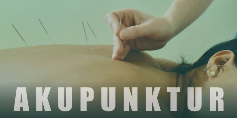 Akupunktur Nedir, Ne İşe Yarar ve Nasıl Yapılır?